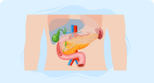 Ampullary carcinoma treatment options