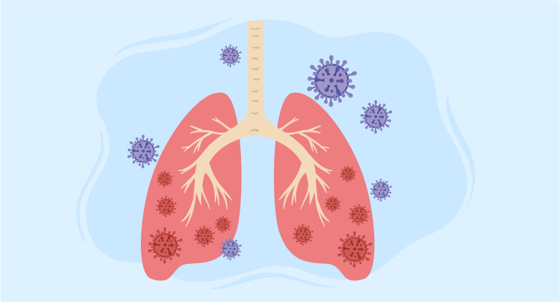 Blastomycosis Diagnosis and Treatment