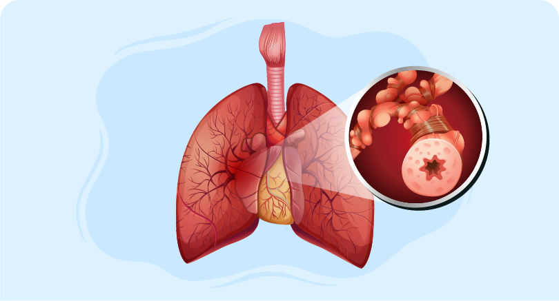 lungs and close up look of center of lungs highlighting COPD care