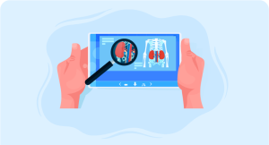 skeleton with kidneys highlighting Strategies against Radiation Nephropathy