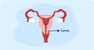 cervix symbolizing The Cervicitis Guide