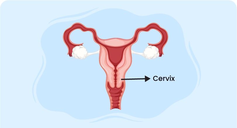 cervix symbolizing The Cervicitis Guide