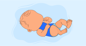 Managing CHILD Syndrome