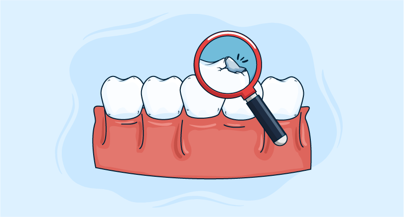 Avulsed tooth management