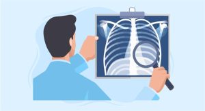 Lung ultrasound techniques