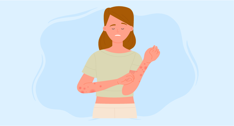 pruritus treatment options