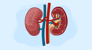 Renal Arteriovenous Malformation treatment options
