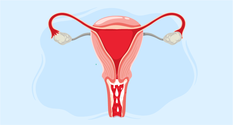 treatment for abnormal vaginal discharge