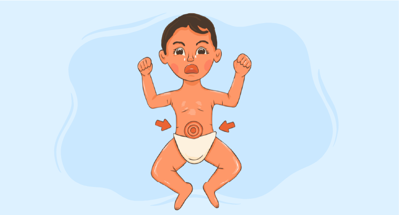 Diagnosis of Prune Belly Syndrome