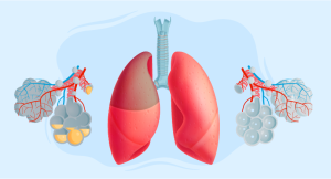 Cardiogenic pulmonary edema management