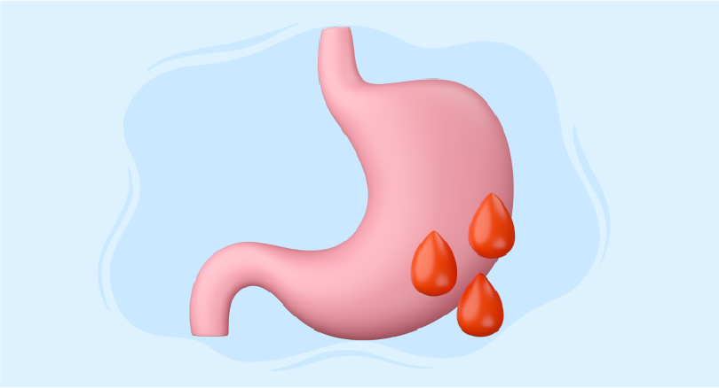 Course on Upper GI bleeding