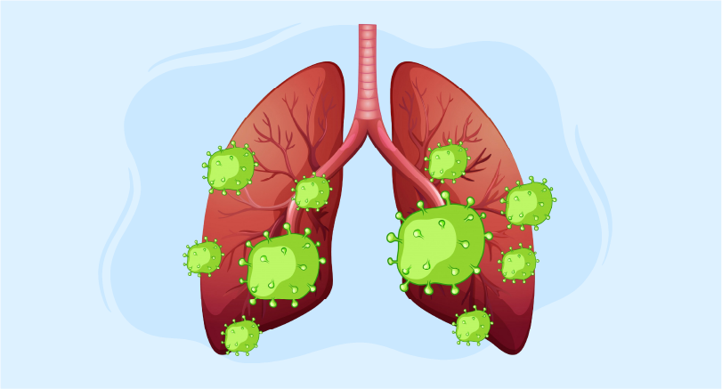 Cardiobacterium infection management