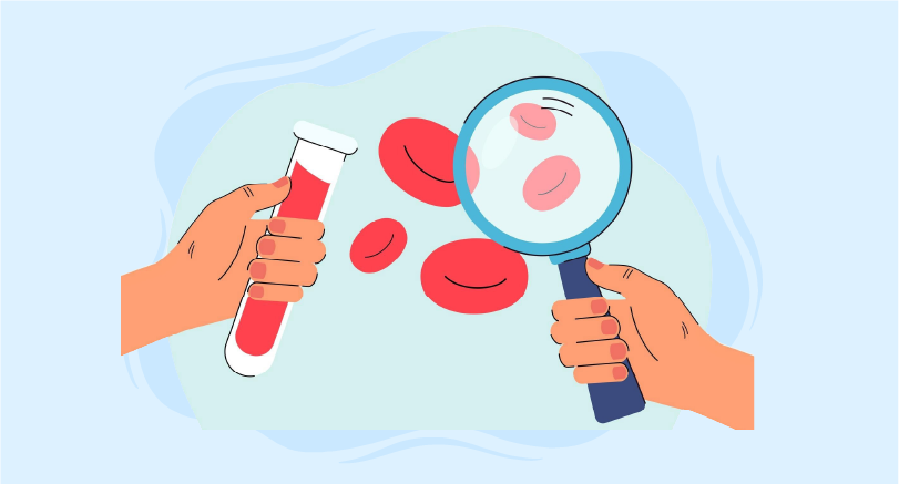 Managing familial chylomicronemia syndrome