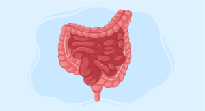 graft versus host disease course