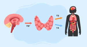 McCune-Albright syndrome treatment